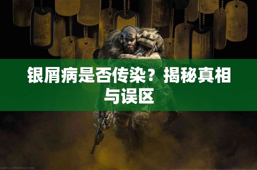 银屑病是否传染？揭秘真相与误区